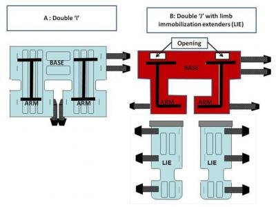 Figure 1: A) ‘Double-I’ construct. B) new improved double ‘J’ with limb immobilization extenders (LIE).